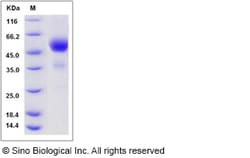 Sino Biological Recombinant Mouse TIGIT Protein (hFc Tag) 1, Quantity: