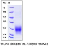 Sino Biological Recombinant Mouse TIGIT Protein (ECD, His Tag), HPLC-verified,