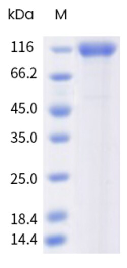 Sino Biological&nbsp;Recombinant Mouse Cadherin-17 Protein (His Tag), HPLC-verified 100