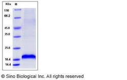 Sino Biological Recombinant Mouse MANF Protein (His Tag), Quantity: Each