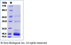 Sino Biological Recombinant Mouse Transthyretin Protein (His Tag), HPLC-verified,