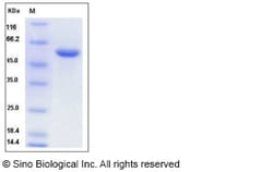 Sino Biological Recombinant Mouse CNDP1 Protein (His Tag), Quantity: Each