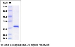 Sino Biological Mouse RPE / RPE2-1 Protein (His Tag) 100ug, Quantity: Each