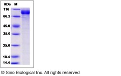 Sino Biological Mouse Semaphorin 5A / SEMA5A Protein (His Tag) 50ug, Quantity: