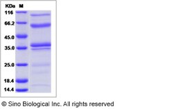 Sino Biological Mouse Complement C1s-A subcomponent Protein (His Tag) 100ug,
