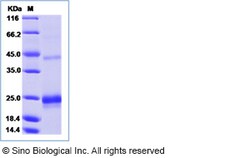 Sino Biological Recombinant Mouse LIGHT/TNFSF14 Protein (His Tag), Quantity:
