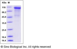 Sino Biological Recombinant Mouse Cadherin-6/K-cadherin Protein (His Tag),