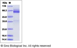 Sino Biological Recombinant Mouse Glypican 3/GPC3 Protein (His Tag), HPLC-verified