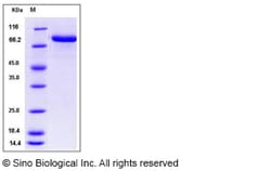 Sino Biological Mouse MFI2 / CD228 / melanotransferrin Protein (His Tag)