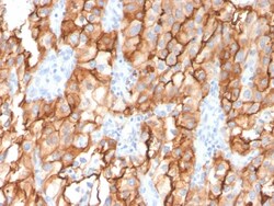 Abcam&nbsp;Mouse monoclonal [MME/2579] to CD10