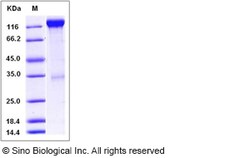 Sino Biological Recombinant Mouse VEGFR2/KDR Protein (hFc Tag), Quantity: