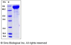 Sino Biological Recombinant Mouse VEGFR2/KDR Protein (His Tag), Quantity: