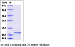 Sino Biological Recombinant Mouse Pleiotrophin/PTN Protein, Quantity: Each