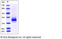 Sino Biological Recombinant Mouse TFPI2 Protein (His Tag), Quantity: Each