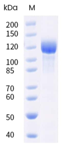 Sino Biological Mouse ERBB3 Protein 1MG (Sino Biological), Quantity: Each