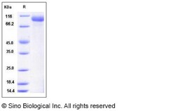 Sino Biological Mouse HER3 / ErbB3 Protein (His Tag) 100ug, Quantity: Each