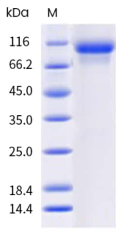 Sino Biological Mouse ERBB3 Protein 20ug (Sino Biological), Quantity: Each