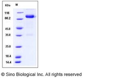 Sino Biological Mouse IL12B / IL-12B Protein (Fc Tag) 50ug, Quantity: Each