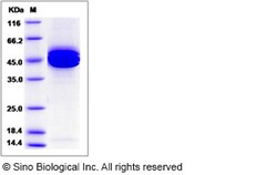 Sino Biological Recombinant Mouse IL-12 p40/IL12B Protein (His Tag) 500,