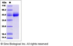 Sino Biological Recombinant Mouse IL-12 p40/IL12B Protein, Quantity: Each