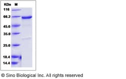 Sino Biological Recombinant Mouse PDK4 Protein (His & GST Tag), Quantity: