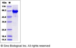 Sino Biological Recombinant Mouse AKT3 Protein (aa 106-479, His & GST Tag),