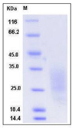 Sino Biological Recombinant Mouse LAIR1 Protein (His Tag), Quantity: Each