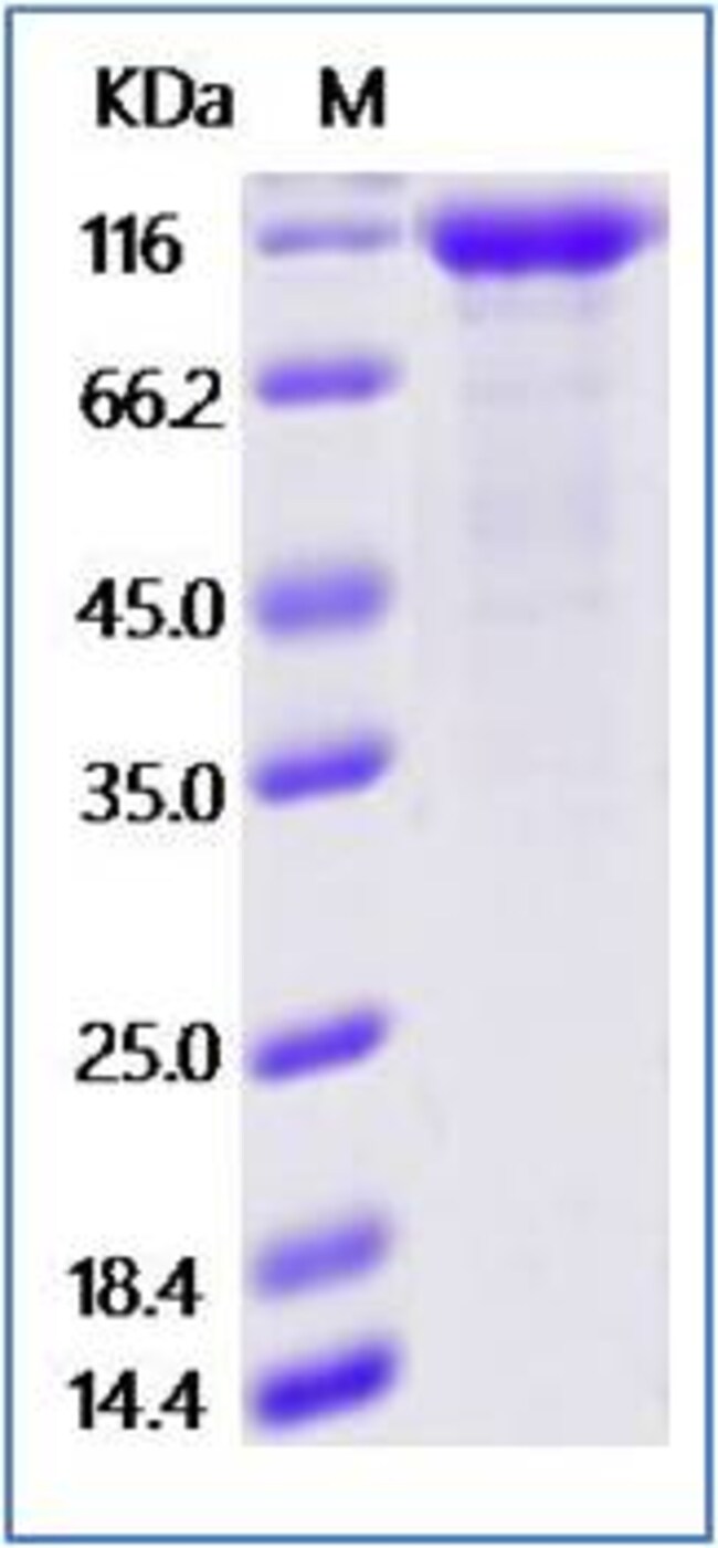 Sino Biological Mouse VEGFR1 / FLT1 Protein (ECD, His Tag) 500ug