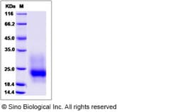 Sino Biological Recombinant Mouse GM-CSF/CSF2 Protein (His Tag) 500, Quantity:
