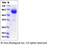 Sino Biological Recombinant Mouse BTLA Protein (hFc Tag), Quantity: Each