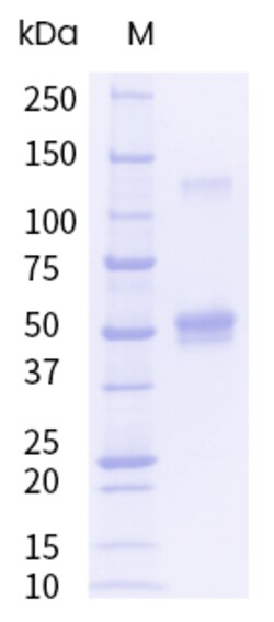 Sino Biological&nbsp;Recombinant Mouse IL-2 Protein (hFc Tag), Endotoxin-Free 100