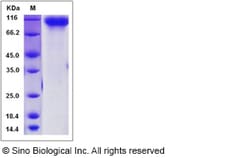 Sino Biological Recombinant Mouse ERBB4/Her4 Protein (His Tag), HPLC-verified,