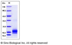 Sino Biological Mouse IL5 Protein (His Tag) 100ug, Quantity: Each of 1