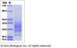 Sino Biological Mouse IL-31 / IL31 Protein (His Tag) 10ug, Quantity: Each