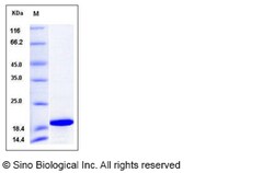 Sino Biological Mouse IL1F8 / IL36b Protein 50ug, Quantity: Each of 1