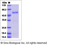 Sino Biological Recombinant Mouse R-Spondin 2/RSPO2 Protein (mFc Tag),