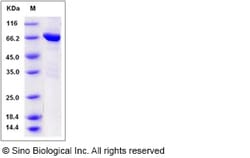 Sino Biological Recombinant Mouse TIE-2 Protein (aa 770-1122, His & GST