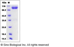 Sino Biological Recombinant Mouse IL1R2 Protein (hFc Tag), Quantity: Each