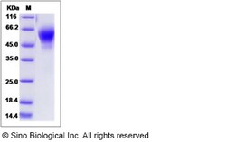 Sino Biological Recombinant Mouse IL1R2 Protein (His Tag), HPLC-verified,