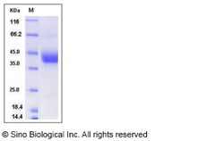 Sino Biological Recombinant Mouse ART4/CD297 Protein (His Tag), Quantity: