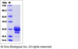 Sino Biological Recombinant Mouse IL-17F Protein (His Tag), Quantity: Each