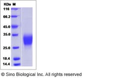 Sino Biological Recombinant Mouse Erythropoietin/EPO Protein, Quantity: