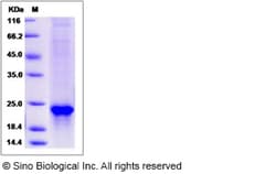 Sino Biological Recombinant Mouse Sonic Hedgehog/SHH Protein (His Tag),