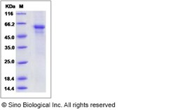 Sino Biological Mouse IL27 / Interleukin-27 Protein (His Tag) 100ug, Quantity: