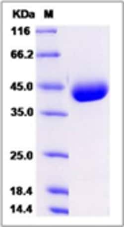 Sino Biological Recombinant Mouse IL-17RB Protein (His Tag), Quantity: