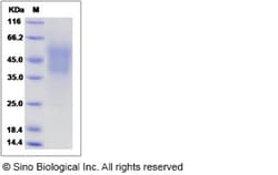 Sino Biological Recombinant Mouse M-CSF/CSF1 Protein (His Tag), Quantity: