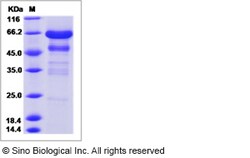 Sino Biological Recombinant Mouse IGFBP2 Protein (hFc Tag), Quantity: Each