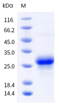 Sino Biological Mouse CD70 Protein 100ug (Sino Biological), Quantity: Each