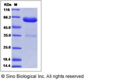 Sino Biological Recombinant Mouse ANTXR2 Protein (hFc Tag), Quantity: Each