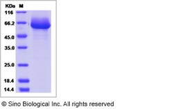 Sino Biological Recombinant Mouse Alkaline Phosphatase/ALPL Protein (His
